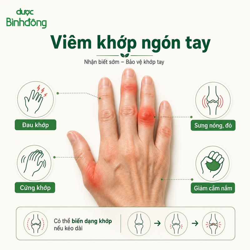 Viêm khớp ngon tay dau hieu nhận biết