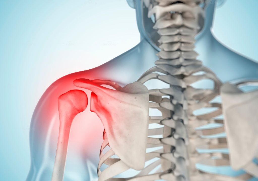 Hình chụp người đàn ông đang bị đau nhức khớp vai
