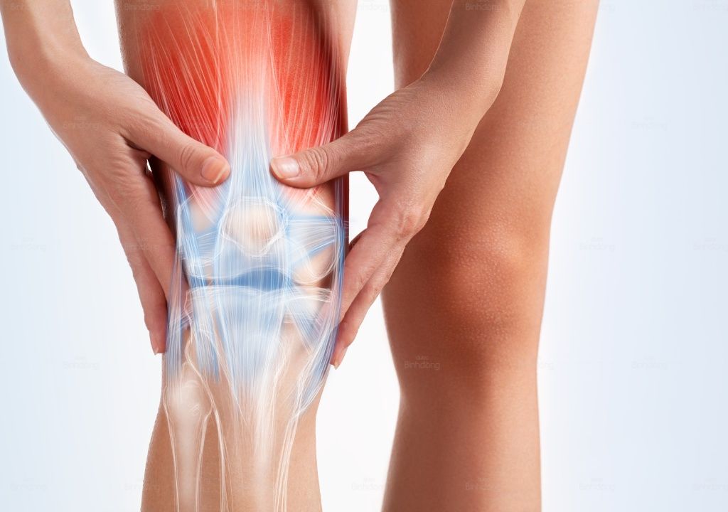 Hình chụp người phụ nữ đang bị đau nhức khớp gối
