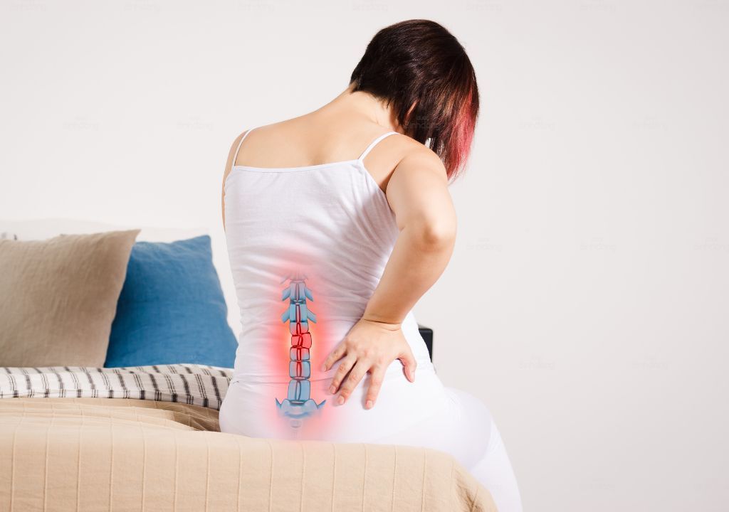 Hình ảnh người phụ nữ đang bị đau thần kinh tọa