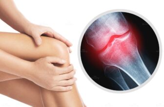 Hình ảnh người phụ nữ đang bị thoái hóa đa khớp