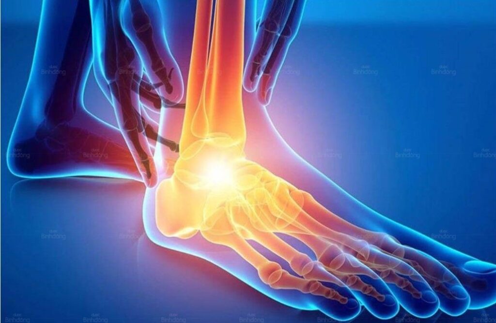 Hình ảnh tình trạng của viêm khớp chân