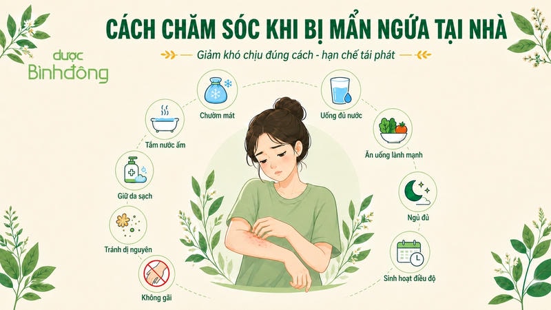 Infographic hướng dẫn cách chăm sóc mẩn ngứa tại nhà như chườm mát, giữ da sạch, tránh gãi và uống đủ nước.