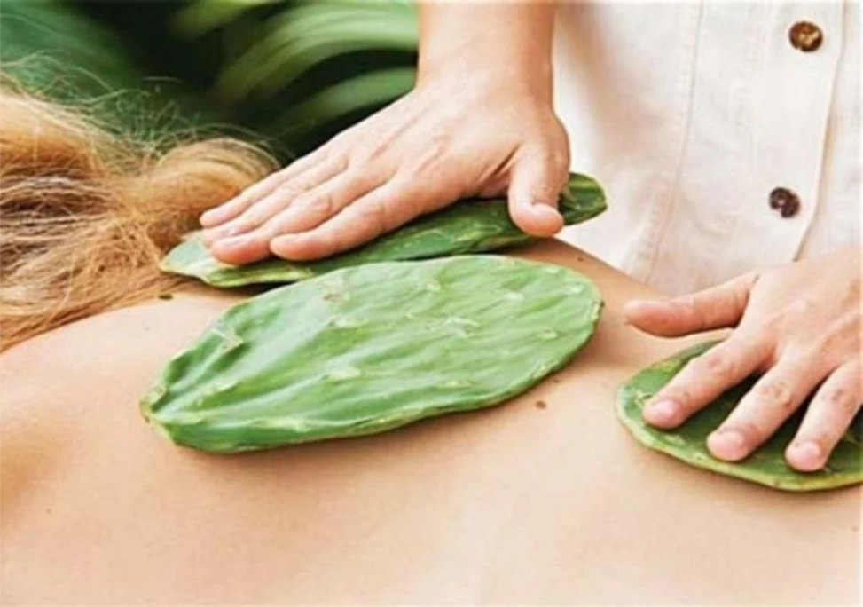 Giúp giảm đau lưng bằng xương rồng