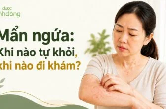 Người phụ nữ đang gãi vùng da nổi mẩn đỏ, kèm tiêu đề về mẩn ngứa khi nào tự khỏi và khi nào đi khám.