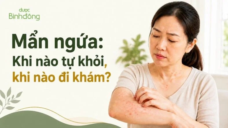 Người phụ nữ đang gãi vùng da nổi mẩn đỏ, kèm tiêu đề về mẩn ngứa khi nào tự khỏi và khi nào đi khám.