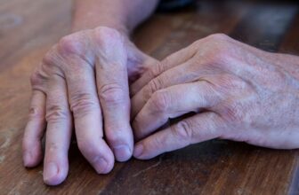 Hình ảnh tình trạng của viêm khớp tay