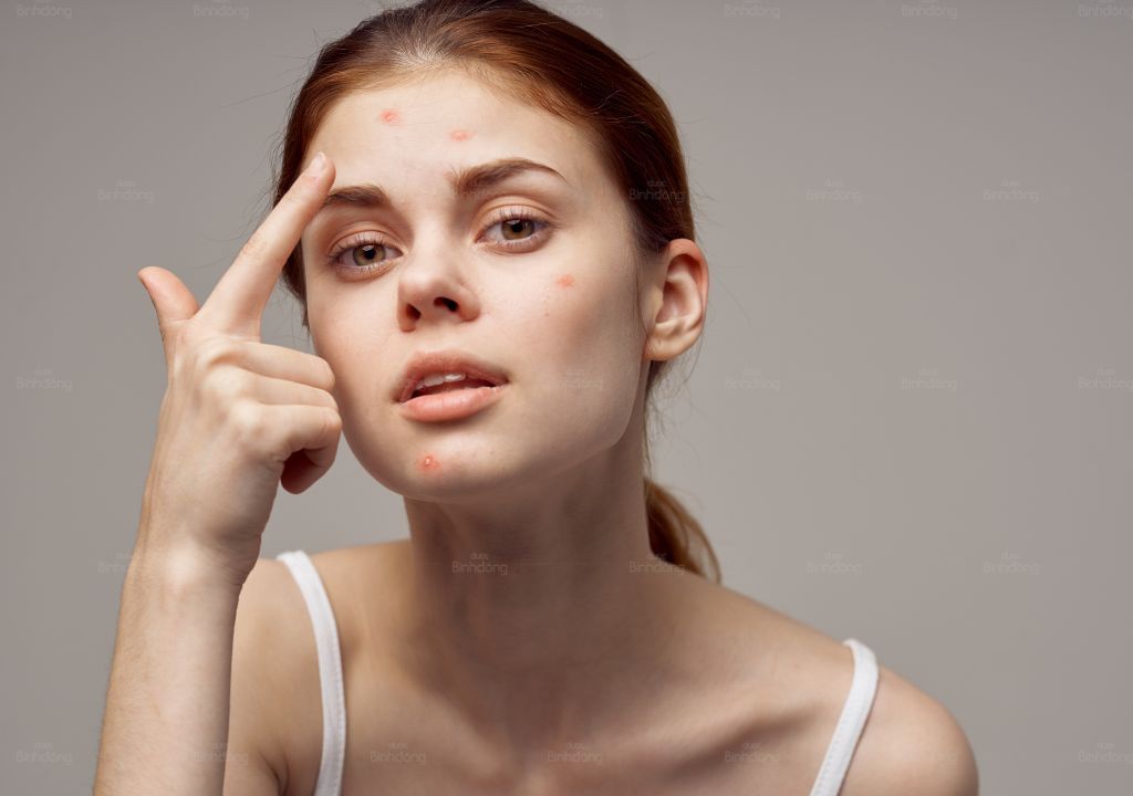 Hình chụp người phụ nữ đang bị gan nhiễm độc nổi mụn