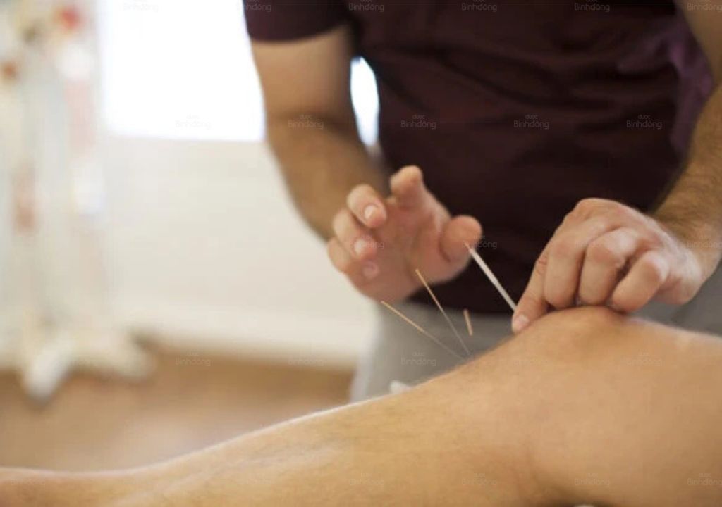 Người đang châm cứu chữa tê bì chân tay