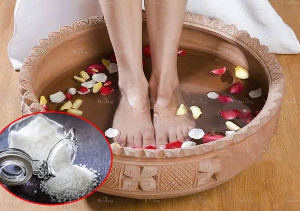 Ngâm chân bằng nước Muối