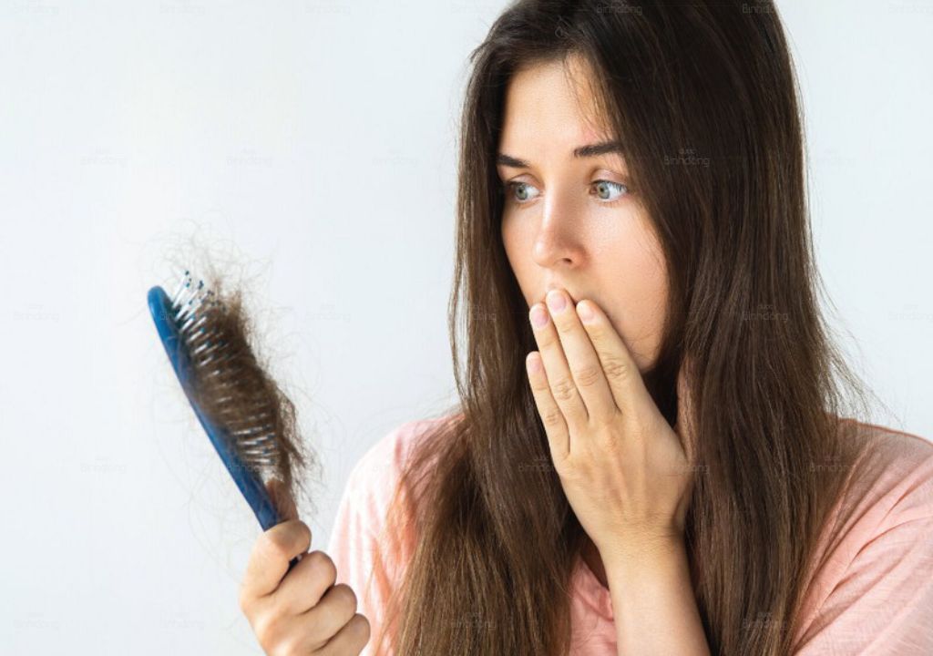 Người phụ nữ bị rụng tóc