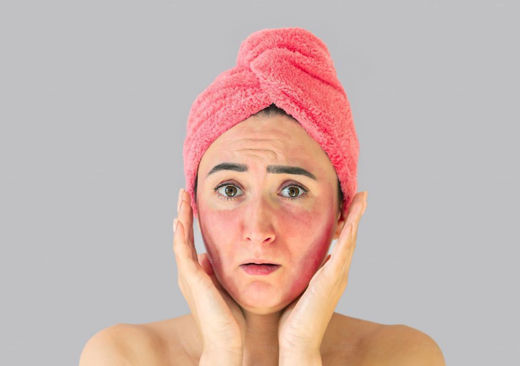 Người phụ nữ bị ngứa ở mặt