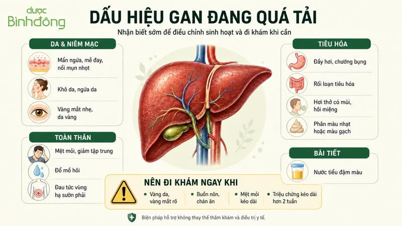 Sơ đồ dấu hiệu Gan quá tải gồm bốn nhóm triệu chứng và cảnh báo khi cần đi khám.