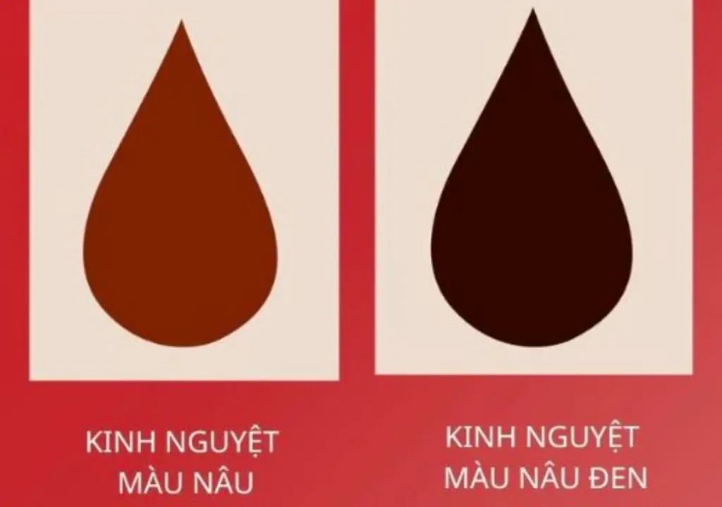 Hình chụp máu kinh màu đen ra ít