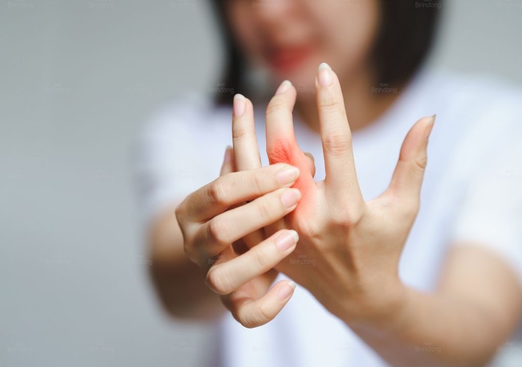 Người phụ nữ bị viêm khớp ngón tay