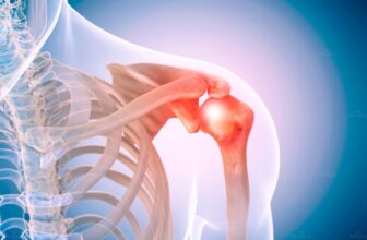 Chăm sóc khớp vai đúng cách – giải pháp phục hồi tại nhà