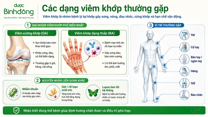 Các dạng viêm xương khớp thường gặp
