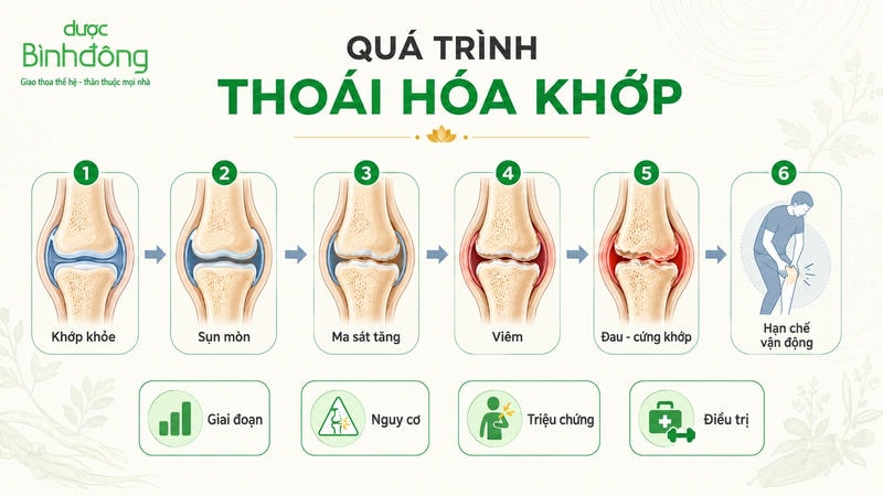 Sơ đồ minh họa quá trình thoái hóa khớp từ khớp khỏe, sụn mòn, tăng ma sát, viêm đến đau cứng và hạn chế vận động