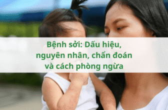 Bệnh sởi: Dấu hiệu, nguyên nhân, chẩn đoán và cách phòng ngừa