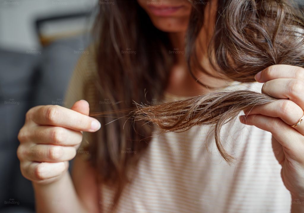 Người phụ nữ bị rụng tóc