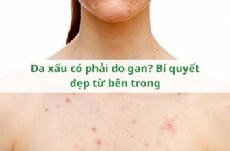 Da xấu có phải do gan? Bí quyết đẹp từ bên trong