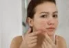 Nổi mụn khi tới tháng do nội tiết tố thay đổi ở nữ giới