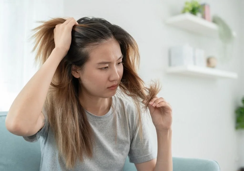 Người phụ nữ lo lắng khi thấy tóc rụng nhiều, gợi ý tình trạng rụng tóc nội tiết.