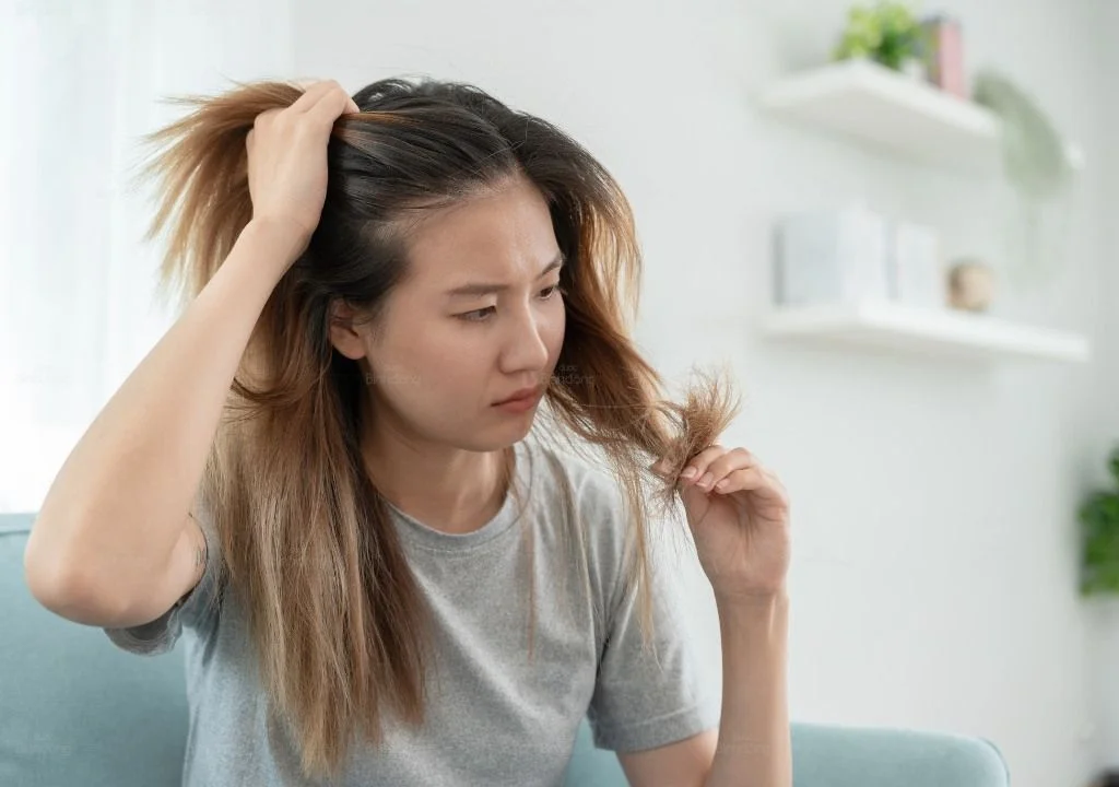 Người phụ nữ lo lắng khi thấy tóc rụng nhiều, gợi ý tình trạng rụng tóc nội tiết.
