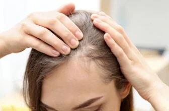 Người phụ nữ kiểm tra vùng tóc thưa và rụng nhiều ở phần chân tóc.
