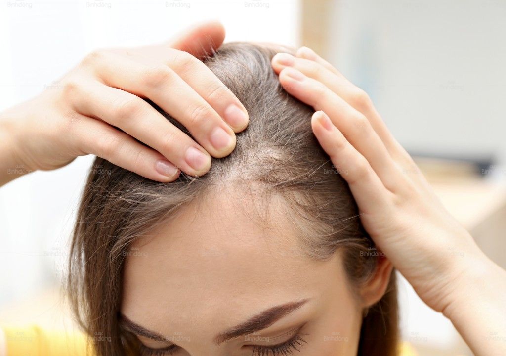 Người phụ nữ kiểm tra vùng tóc thưa và rụng nhiều ở phần chân tóc.