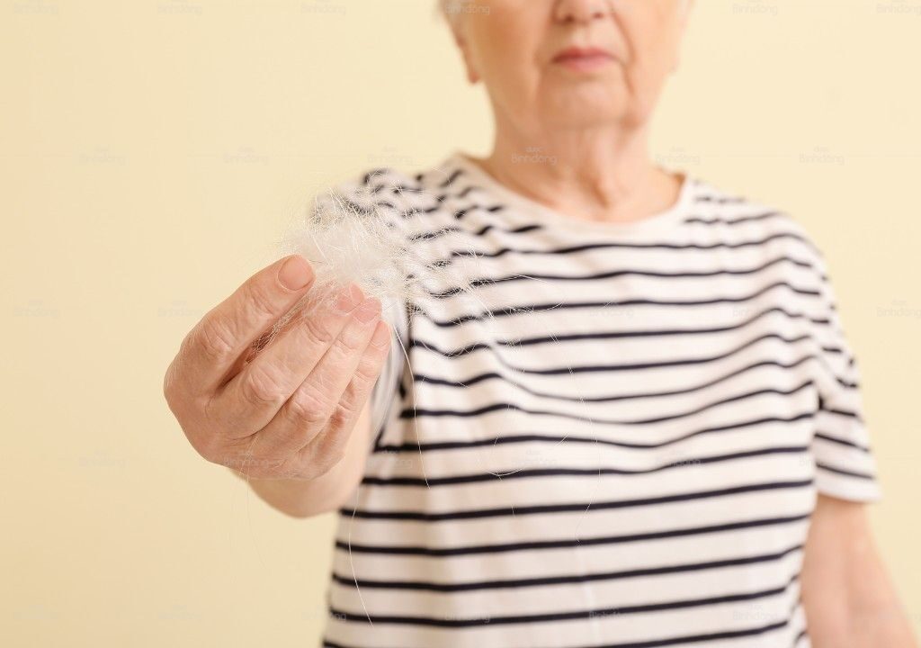 Phụ nữ tiền mãn kinh lo lắng khi tóc rụng nhiều và đường ngôi thưa rõ.