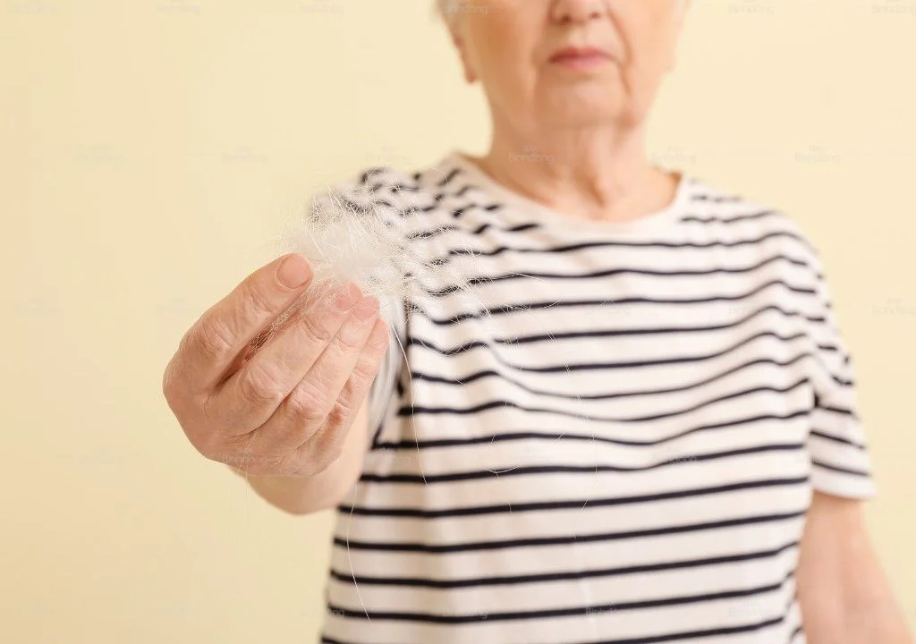 Phụ nữ tiền mãn kinh lo lắng khi tóc rụng nhiều và đường ngôi thưa rõ.
