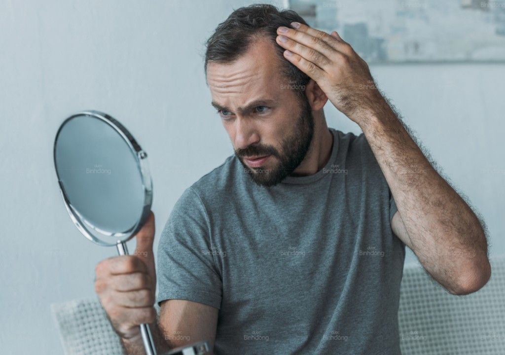Nam giới trung niên soi gương kiểm tra vùng tóc thưa ở đỉnh đầu.