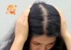Người phụ nữ kiểm tra vùng tóc thưa và rụng nhiều ở phần chân tóc.
