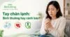 Người phụ nữ xoa hai bàn tay lạnh bên ba biểu tượng về triệu chứng, tuần hoàn máu và thăm khám.