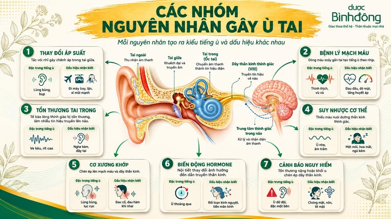 Infographic mô tả bảy nhóm nguyên nhân gây ù tai cùng đặc trưng tiếng ù và dấu hiệu nhận biết.
