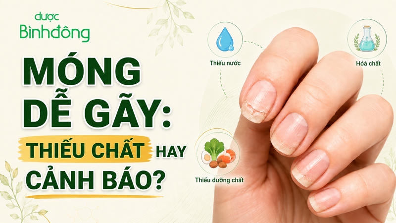 móng dễ gãy, giòn thumbnail