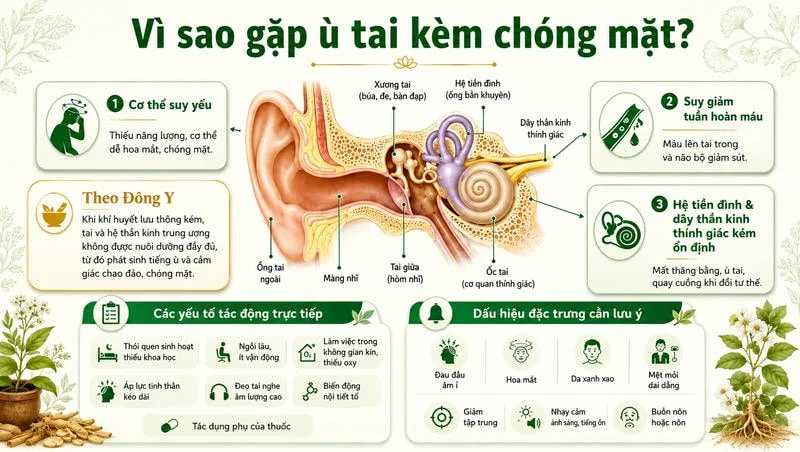 Sơ đồ cắt lớp tai minh họa ba nguyên nhân chính và dấu hiệu đi kèm của ù tai chóng mặt.