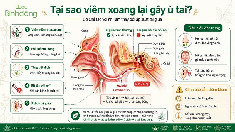 Sơ đồ viêm xoang gây ù tai cho thấy tắc vòi nhĩ gây đổi áp suất và ứ dịch.
