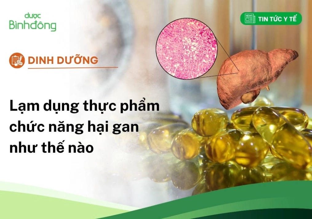 Lạm dụng thực phẩm chức năng hại gan