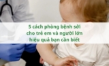 5 cách phòng bệnh sởi cho trẻ em và người lớn hiệu quả bạn cần biết
