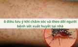 6 điều lưu ý khi chăm sóc và theo dõi người bệnh sốt xuất huyết tại nhà