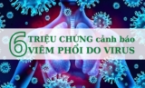 6 triệu chứng cảnh báo viêm phổi do virus bạn không nên bỏ qua