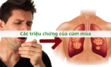 Các triệu chứng của cúm mùa