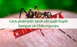 Cách phân biệt bệnh sốt xuất huyết Dengue và Chikungunya