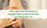 Mẩn ngứa kéo dài không rõ nguyên nhân có thể là tín hiệu gan đang kêu cứu