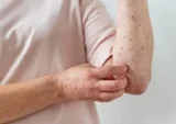 Viêm amidan có nên cắt không?     