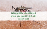 Những điều cần biết khi chăm sóc người bệnh sốt xuất huyết