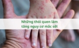 Những thói quen làm tăng nguy cơ mắc sởi