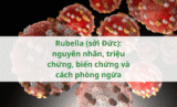 Rubella (sởi Đức): nguyên nhân, triệu chứng, biến chứng và cách phòng ngừa